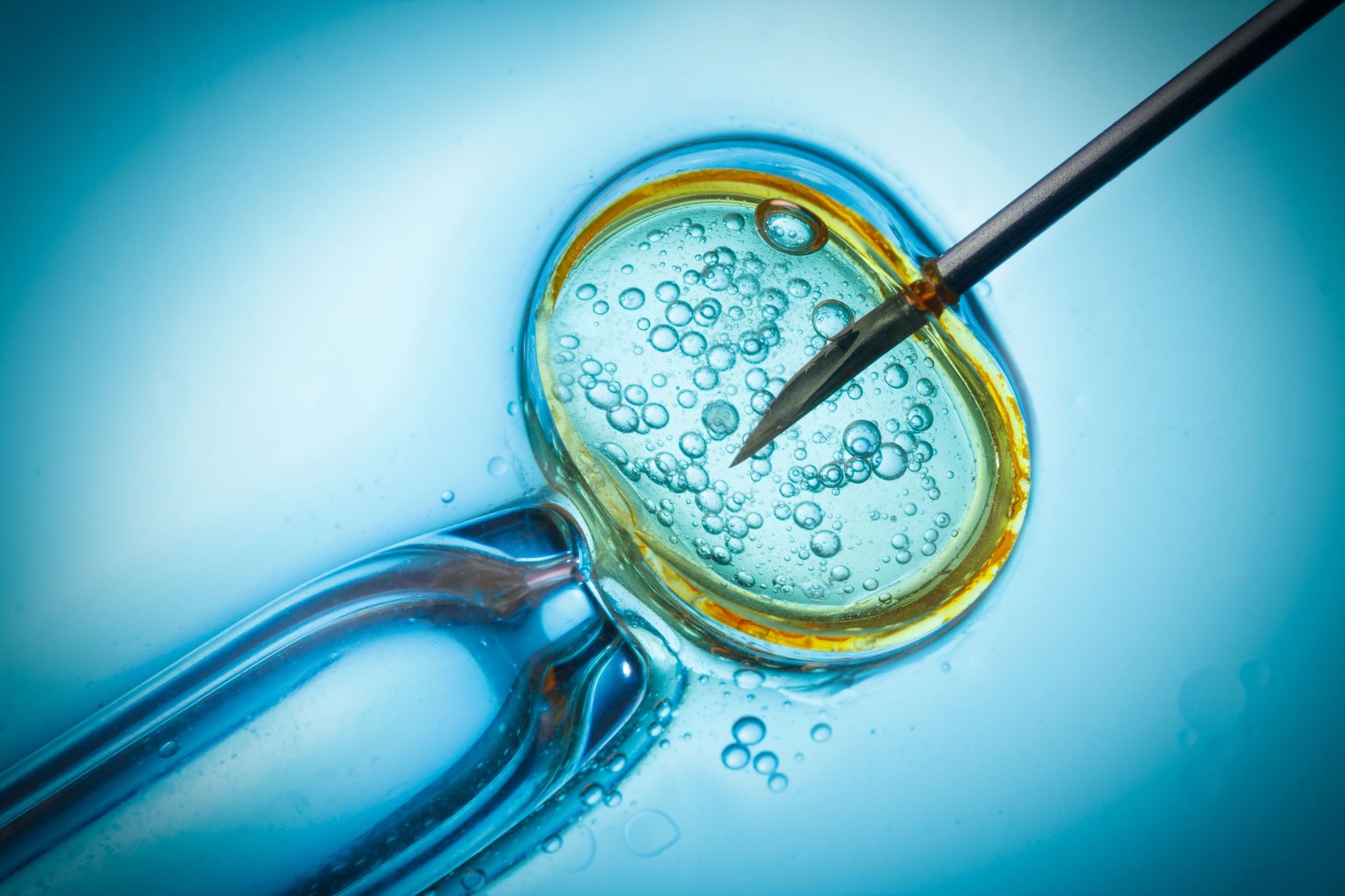 ivf-treatment-image